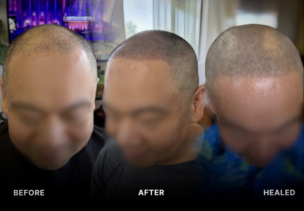 smp results before and after